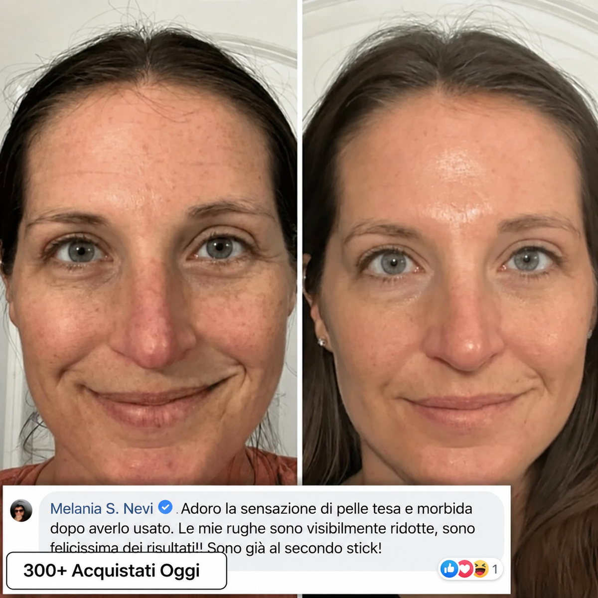 Stick Rimpolpante Bio-Collagene PDRN