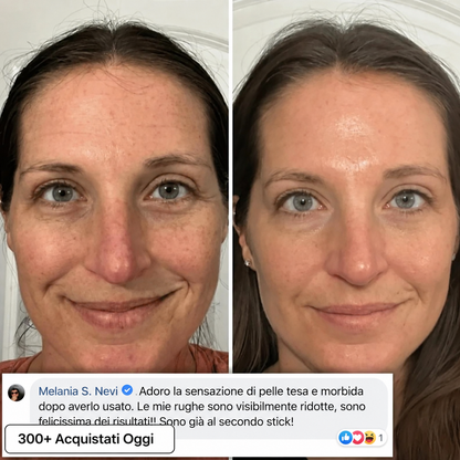 Stick Rimpolpante Bio-Collagene PDRN