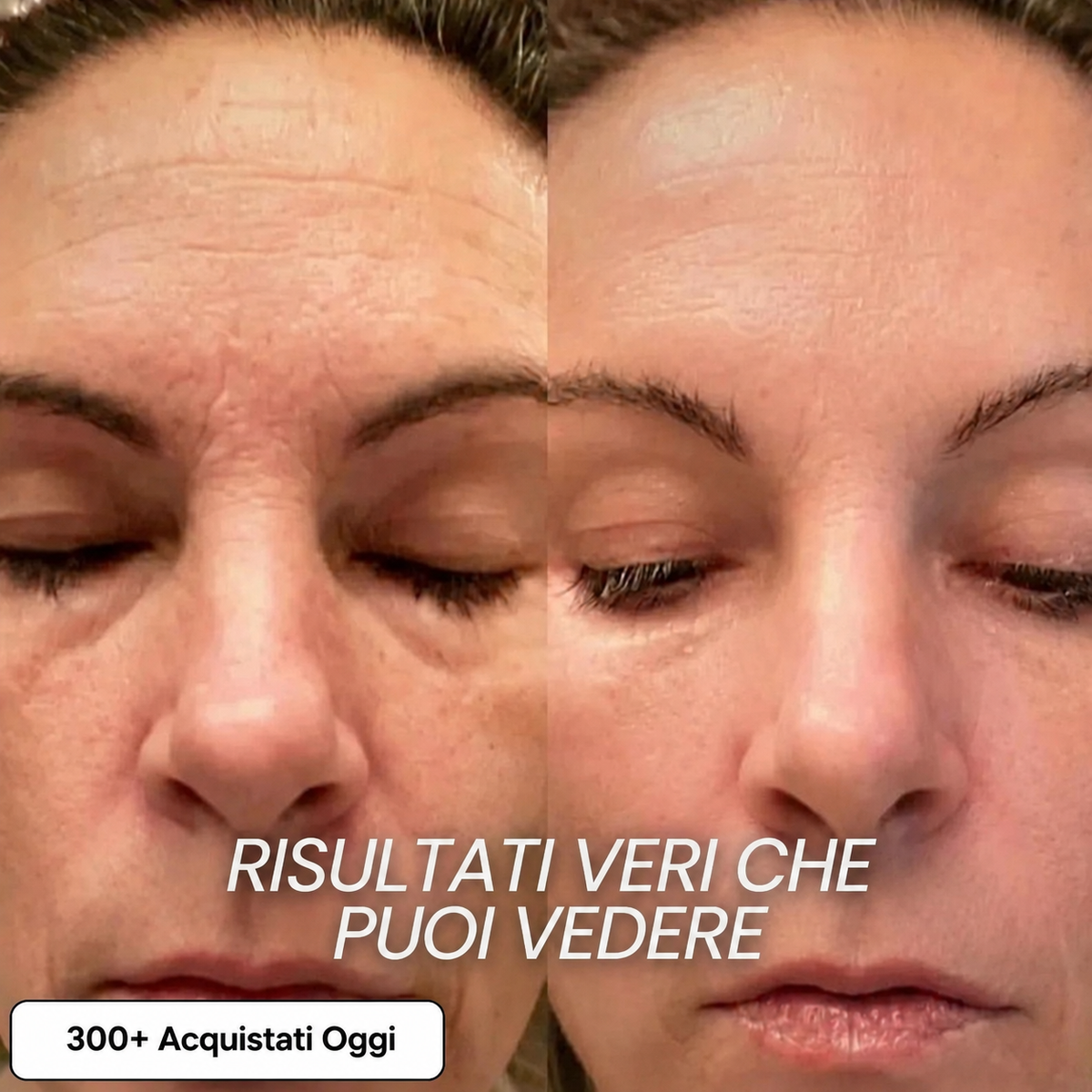 Stick Rimpolpante Bio-Collagene PDRN