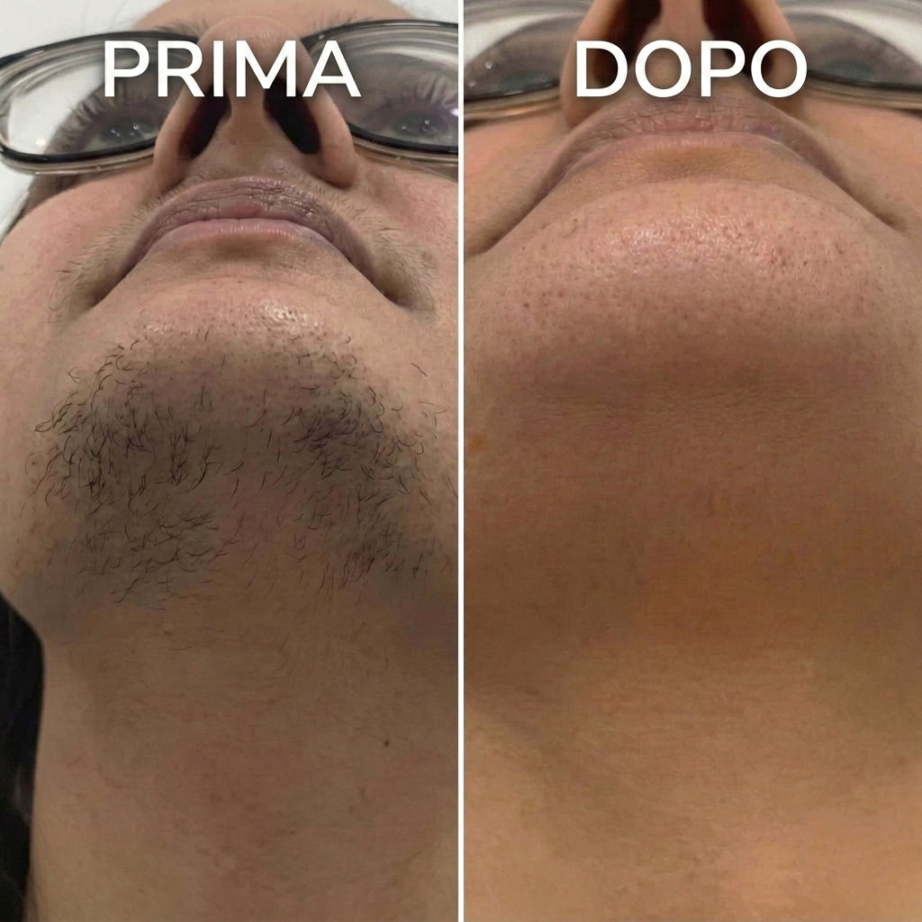 Stop alla Ricrescita dei Peli, Formula Vegetale