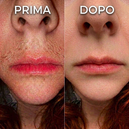 Stop alla Ricrescita dei Peli, Formula Vegetale
