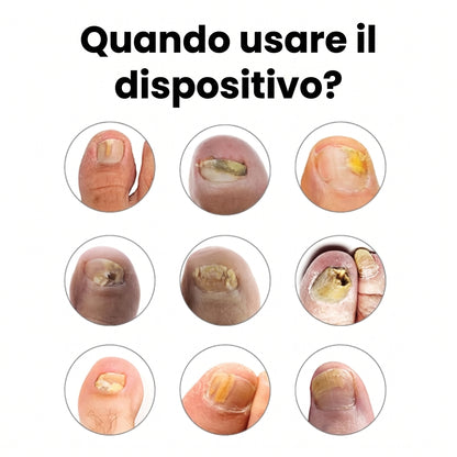 Dispositivo Ripozen